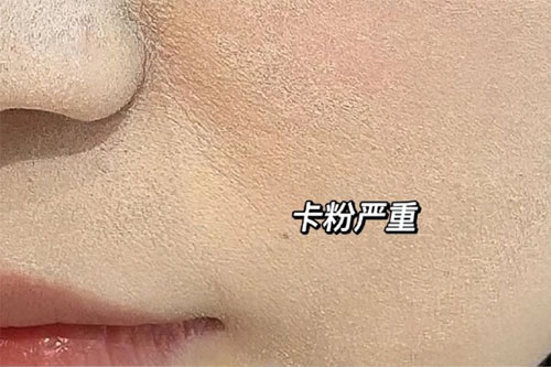 卡粉是什么意思？卡粉是什么原因引起的？