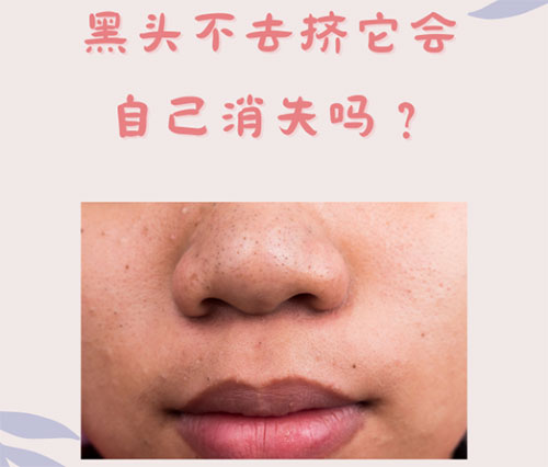 什么是黑頭？怎樣預防黑頭的形成？
